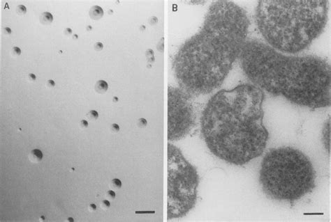 A Typical Fried Egg Morphology Of Colonies Of Crocodile Mycoplasma Download Scientific