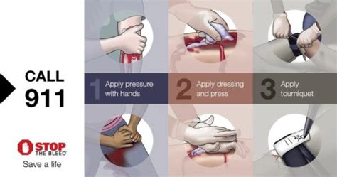 Stop The Bleed Instructor Resources