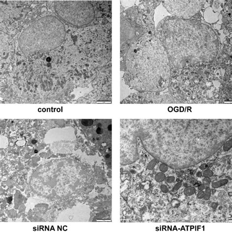 Morphological Changes In The Mitochondria In Each Group OGD R Oxygen