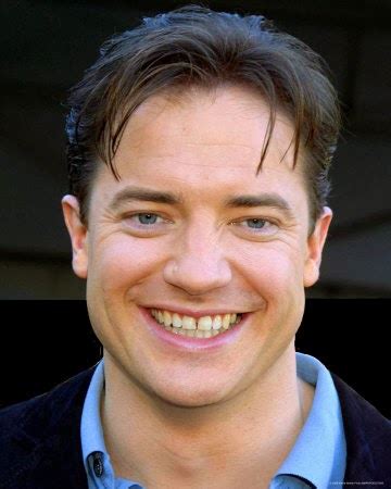 Brendan Fraser Plastic Surgery Hair Transplant Before And After Star