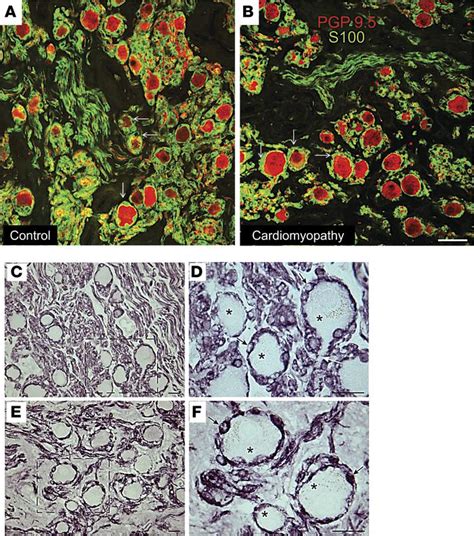 JCI Insight Inflammation Oxidative Stress And Glial Cell Activation