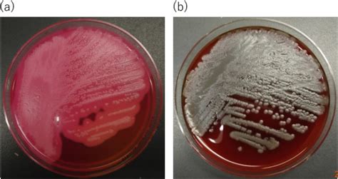 Detection Of Bacillus Cereus As A Causative Agent Of Emetic Food