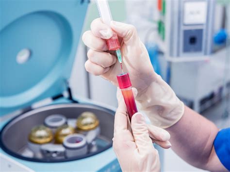 Platelet-Rich Plasma (PRP) And Knee Pain