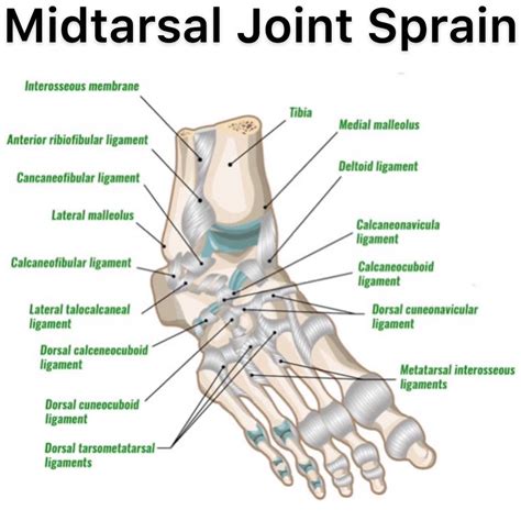 physioosteobook midtarsal joint sprain
