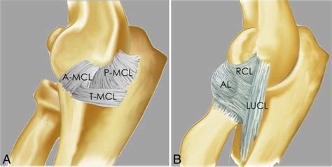 The Elbow Review Of Anatomy And Common Collateral Ligament Complex Pathology Using Mri Mri