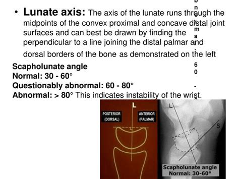 Ppt Normal Wrist Joint Powerpoint Presentation Id1102536