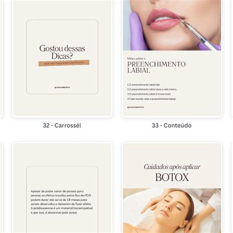 Posts Estética Editáveis Pack Canva Suporte Elo7