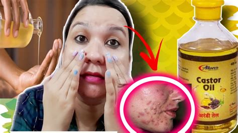 I Used Castor Oil On My Skin Everyday For 5 Days And This Is What Happened Ll Castor Oil Face