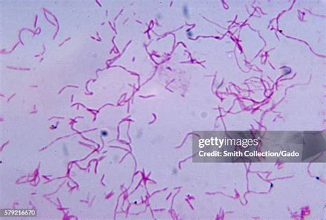 fusobacterium nucleatum   premium high res pictures getty images