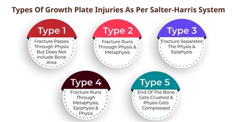 Growth Plate Injuries Treatment In Ludhiana Growth Plate Injuries