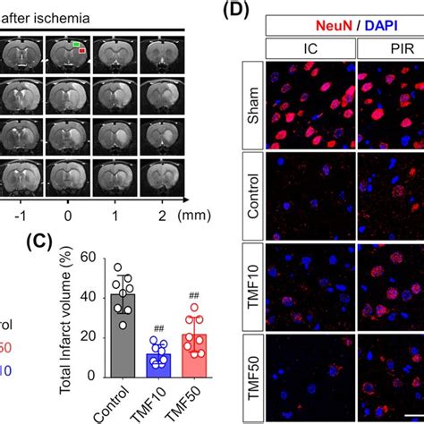 Inhibition Of Aryl Hydrocarbon Receptor AhR Activation And Magnetic