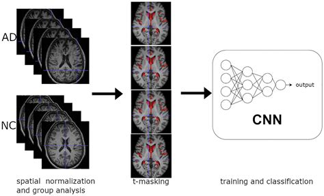 Frontiers Voxel Wise Feature Selection Method For CNN Binary