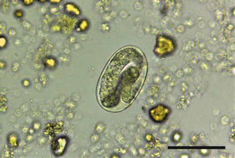 Strongyloides Egg