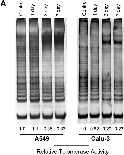 Bibr1532 A Selective Telomerase Inhibitor Enhances Radiosensitivity