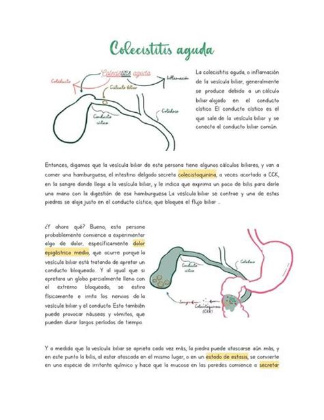 Colecistitis Ana Lilia Valle Udocz