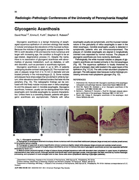 (PDF) Glycogenic acanthosis