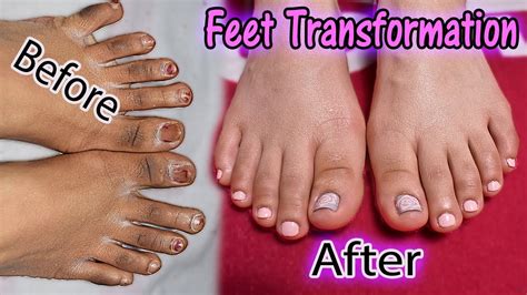 Fugly Feet Transformation Diy Salon Perfect Pedicure At Home Get Summer Ready With Me