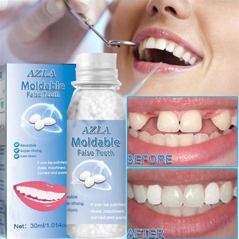 Temporary Dental Restoration False Teeth Solid Glue Temporary Tooth