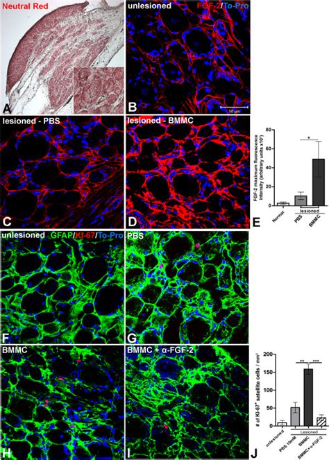 Increased Expression Of Fgf 2 Is Time Correlated With Increased