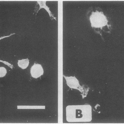 Indirect Immunofluorescence With 1 Antibodies Recognising The Hla Dr