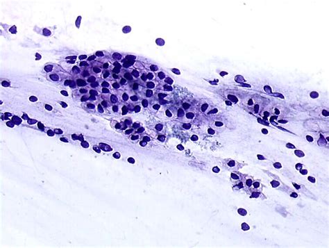 Cytopathology Of The Uterine Cervix Digital Atlas