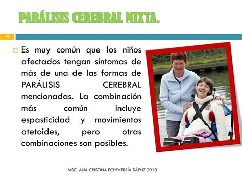 PPT Parálisis Cerebral Infantil y Discapacidad múltiple PowerPoint