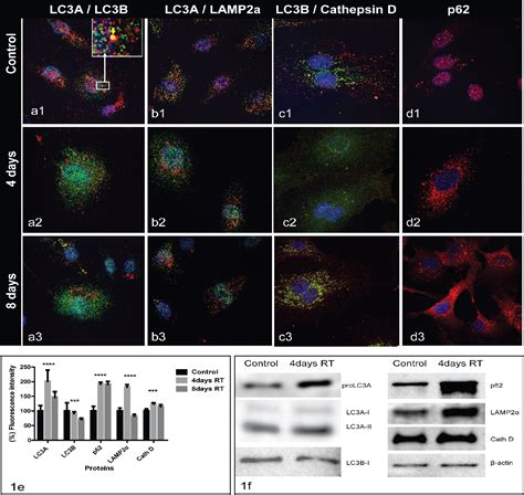 Figure From Important Role Of Autophagy In Endothelial Cell Response