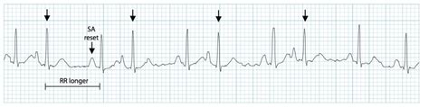 Cardiac EKG Jeopardy Template