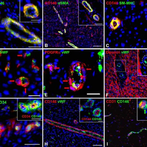 Identification Of Resident Microvascular Pericytes In Human Ventricular