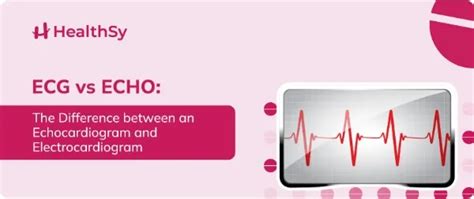 Ecg Vs Echo Difference Between An Echocardiogram And Electrocardiogram Healthsy Article