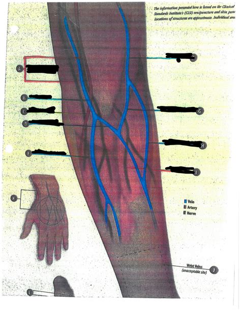 ARM Diagram Diagram | Quizlet