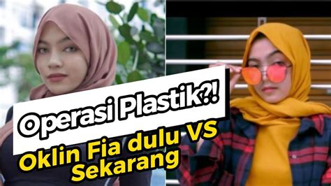 Oklin Fia Foto Dulu Vs Sekarang Oplas Youtube