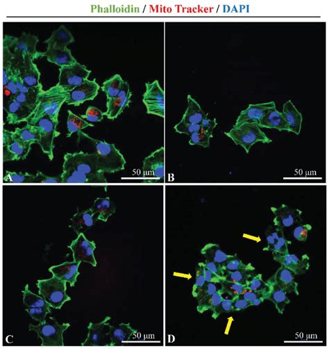 Cytoskeletal Changes By Ultrasound Combined With Psp Mb Representative