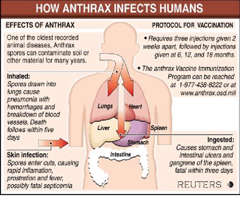 anthrax symptoms - pictures, photos