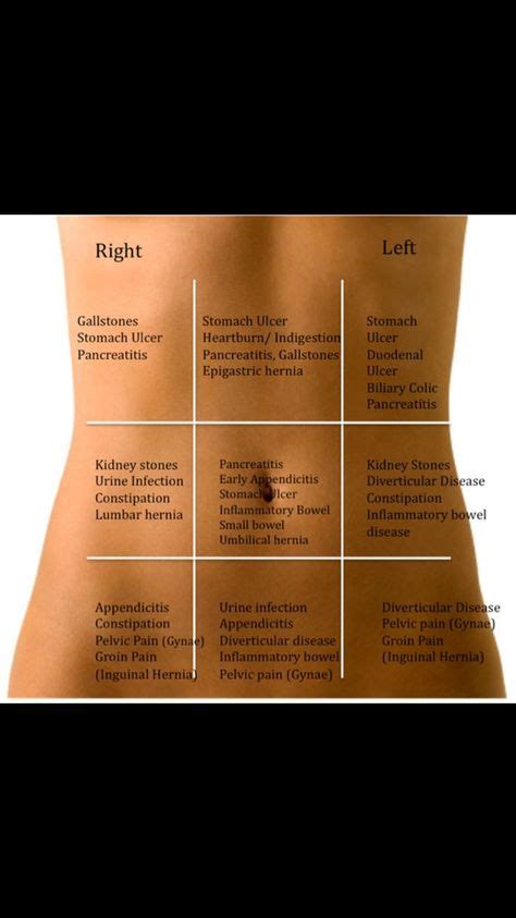 Abdominal Pain Chart Female