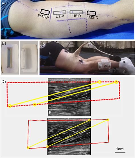 A The Marker Path Of The Biceps Femoris Long Head Locations Of