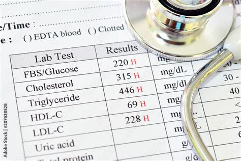 Abnormal High Results Of Lipid Profile And Blood Sugar Test With