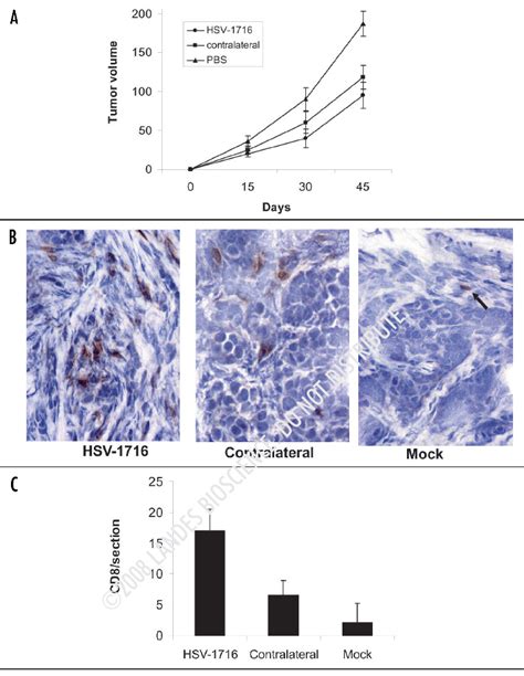 Hsv 1716 Oncolytic Effect On Id8 Vegf Syngeneic Tumor Model A Tumor