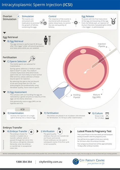 Icsi Intracytoplasmic Sperm Injection City Fertility Centre