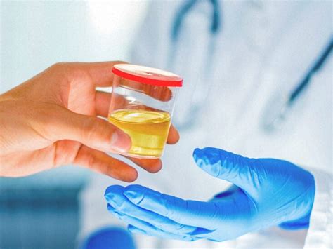 Quick Way To Pass Urine Test Just For Guide