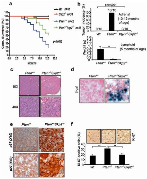 Skp Targeting Suppresses Tumorigenesis By Arf P Independent Cellular