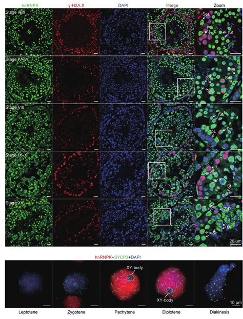 Spatiotemporal Localization Of Hnrnpk In Adult Mouse Testicular Cells