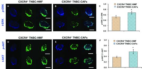 Cryosections Of Co Culture Spheroids Of CXCR4 TNBC Cells Green With