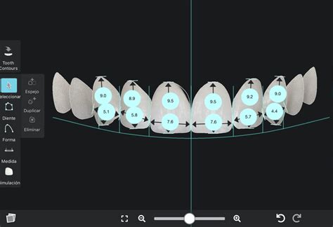 Dise O De Sonrisas Barcelona Smile Center