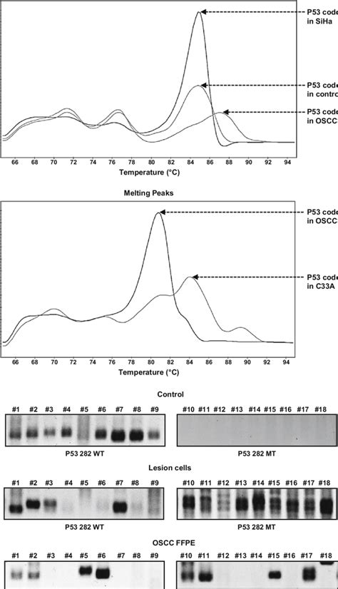 Representative Traces Showing Aso Rt Pcr Melting Peaks For Pcr Products