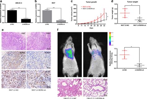 BORA Regulates Cell Proliferation And Migration In Bladder Cancer