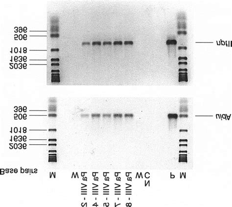 Pcr Analysis Of Transgenic P Abies Tissue Lines To Detect The Uida And