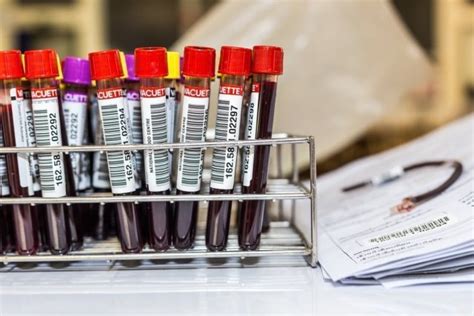 Заболевания кровеносной системы | MedAboutMe