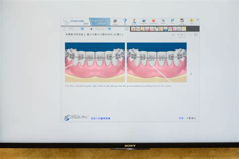 感謝台南遠東牙醫開啟了我的另一扇窗，牙齒矯正透明戴蒙讓我變得不一樣 4 電腦說明牙線使用方式 凱莉怪妞 Flickr