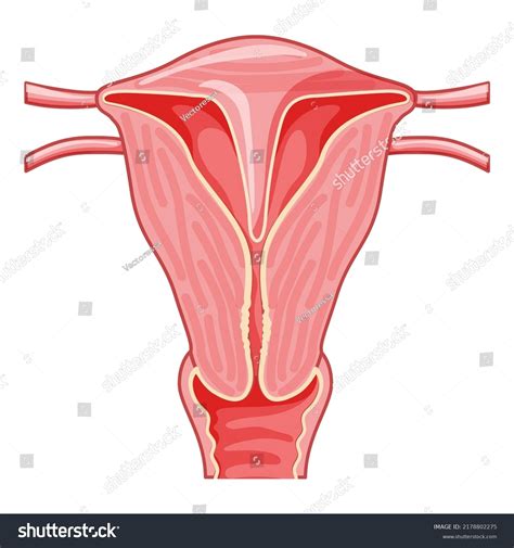 Vektor Stok Uterine Septum Septate Uterus Female Reproductive Tanpa